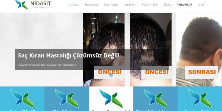 Nidasit Hair Lotions Web Sitesi Tasarımı